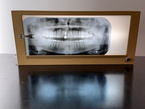 Vintage dental illuminated - vintage,